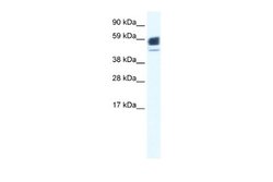 Nicotinic Acetylcholine R alpha 1/CHRNA1 Rabbit anti-Human, Polyclonal,